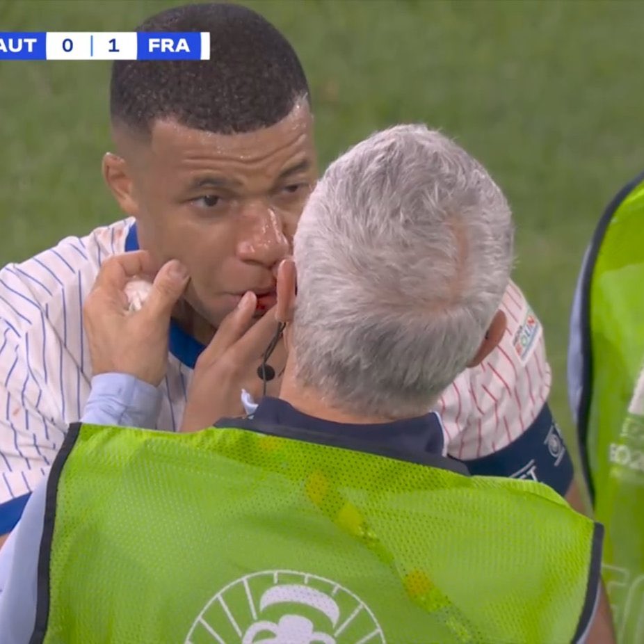 Terrible coup dur pour Mbappé !!